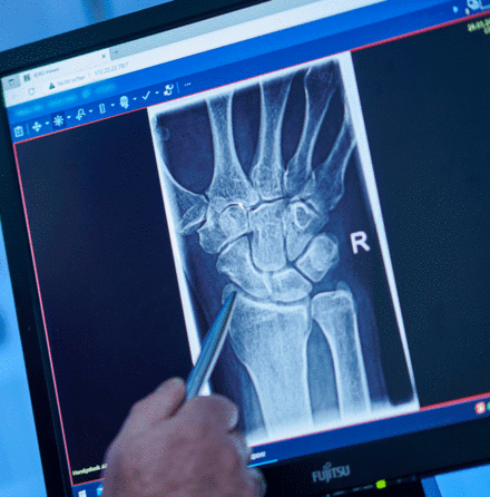 Röntgenbild einer Hand